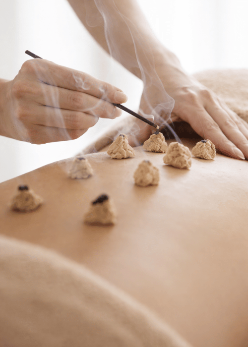 Moxibustion